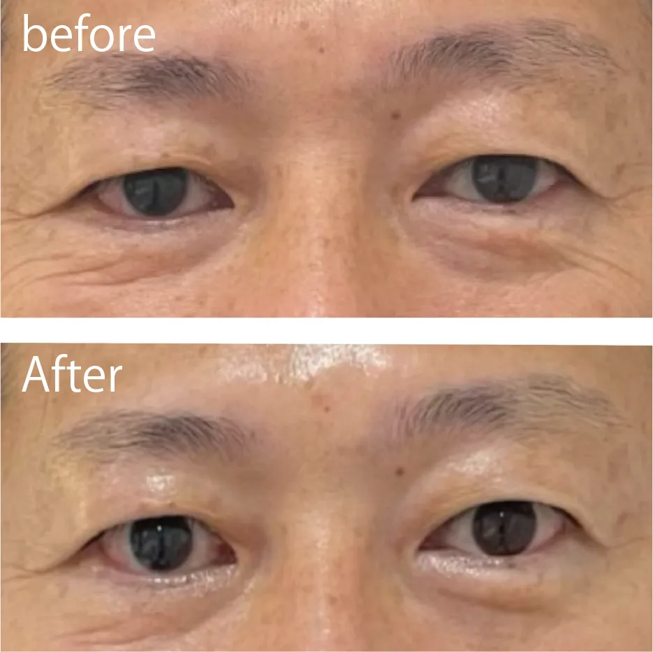 ビフォーアフター：レーシングドライバー